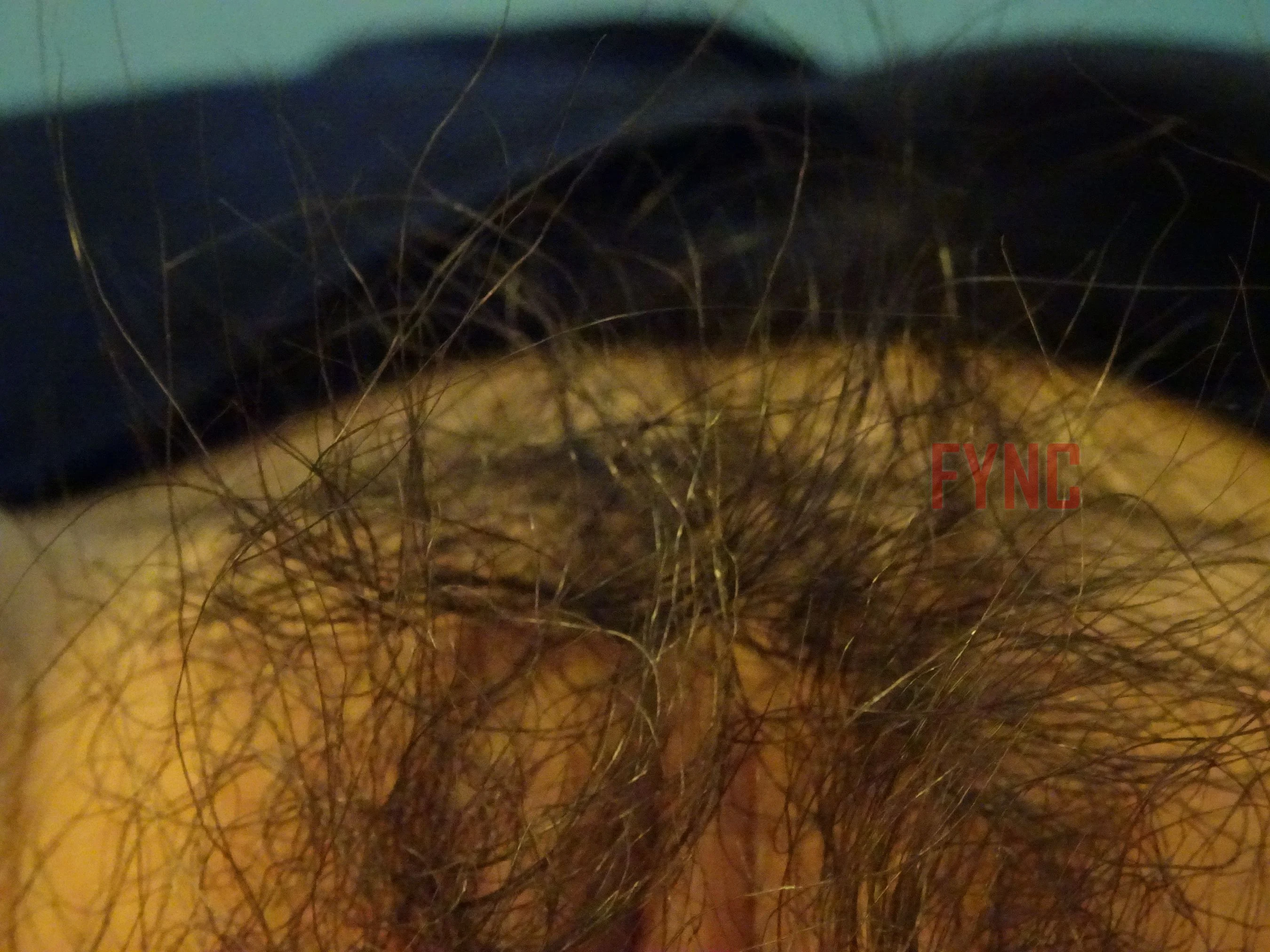 国模林子晴大尺度人体私拍套图 - Photo 250